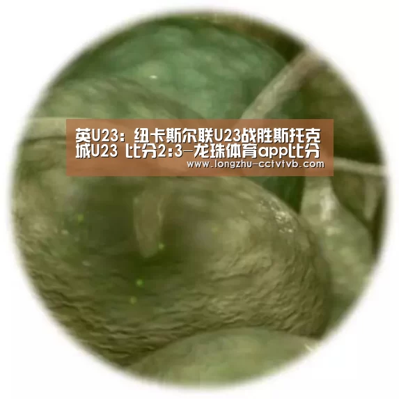 英U23: 纽卡斯尔联U23战胜斯托克城U23 比分2:3-龙珠体育app比分直播(图3) 赛事数据直播
